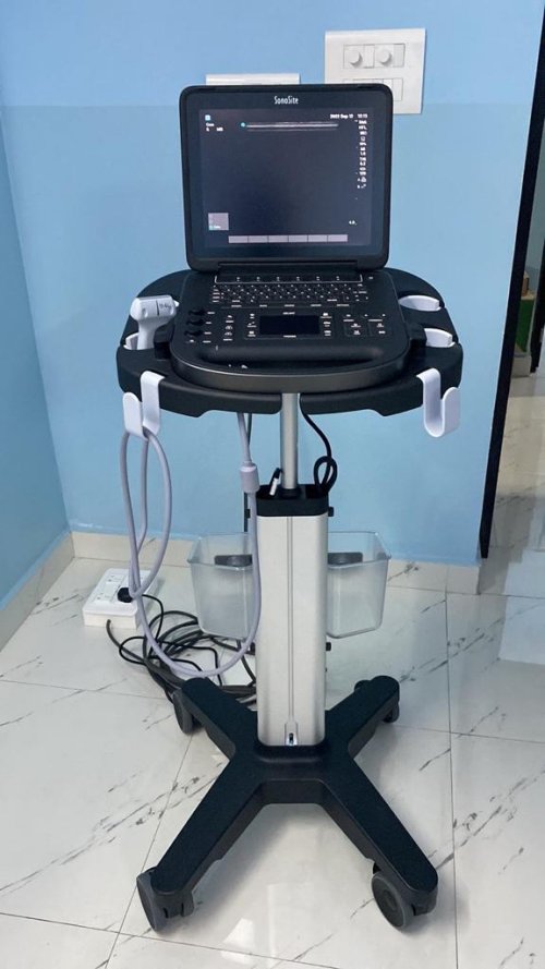 Ultrasound Machine for Diagnosis and Treatment
